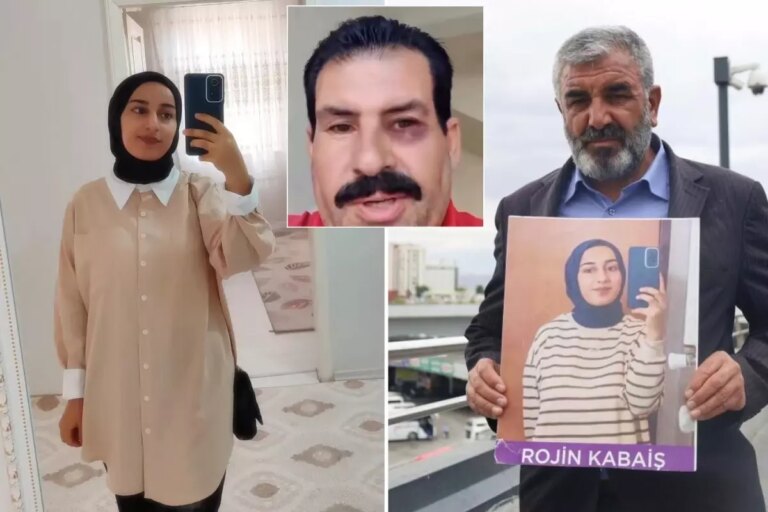 rojin kabaise hakaret eden sahistan yeni video gozumu simsiyah ettiler 5HRluXaS.jpg